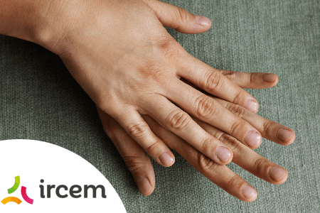 8348-les-ongles-ce-qu-ils-revelent-sur-votre-sante